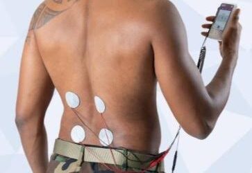 Supporting VQ OrthoCare Through Connector Lifecycle Challenges