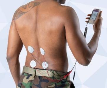 Supporting VQ OrthoCare Through Connector Lifecycle Challenges